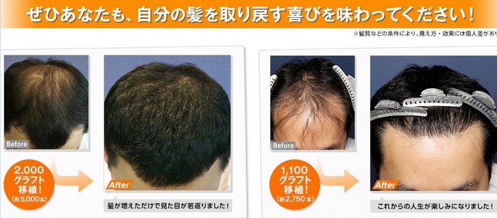 �y�A�C�����h�^���[�N���j�b�N�z�ɂ���